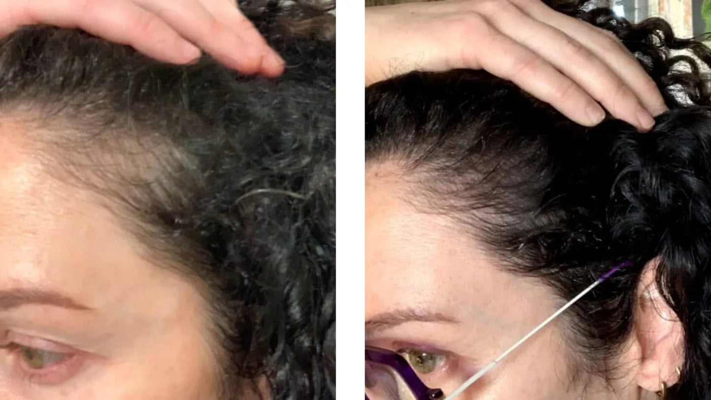 Bela Belinda Tratamento Biocompatível para Crescimento/Anti-Queda